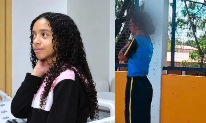 Menina atacada por mais de 100 abelhas recebe alta após uma semana internada